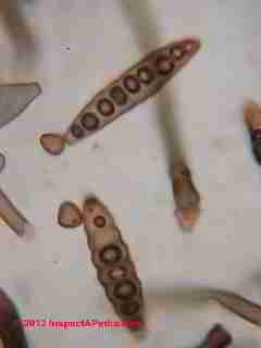 Bipolaris - Drechslera fungal spores (C) D Friedman